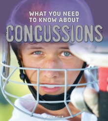 Image for What You Need to Know about Concussions