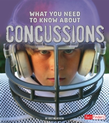 Image for What you need to know about concussions