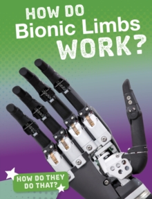 Image for How Do Bionic Limbs Work?