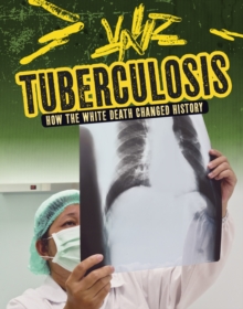 Image for Tuberculosis