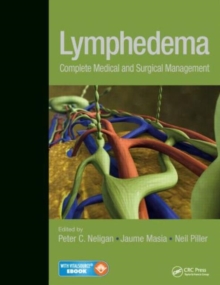 Image for Lymphedema  : complete medical and surgical management