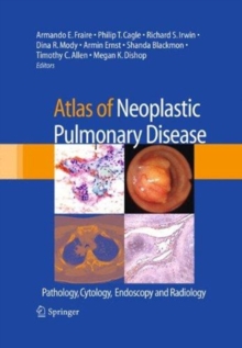 Image for Atlas of Neoplastic Pulmonary Disease