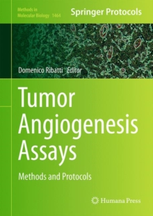Image for Tumor angiogenesis assays: methods and protocols