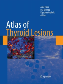 Image for Atlas of Thyroid Lesions