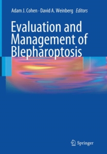 Image for Evaluation and Management of Blepharoptosis