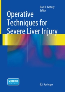Image for Operative Techniques for Severe Liver Injury