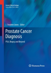 Image for Prostate Cancer Diagnosis