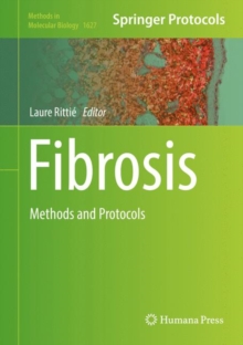 Image for Fibrosis: Methods and Protocols