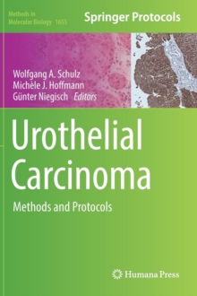 Image for Urothelial Carcinoma : Methods and Protocols