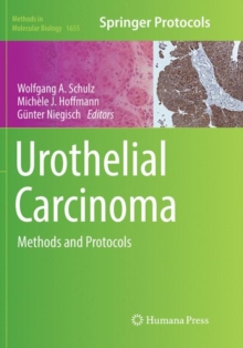 Image for Urothelial Carcinoma