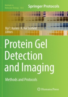 Image for Protein Gel Detection and Imaging : Methods and Protocols