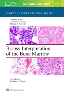 BIOPSY INTERPRETATION BONE MARROW