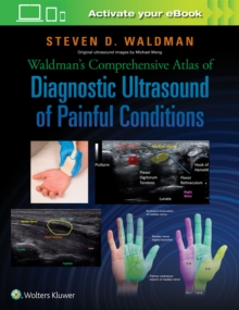 Waldman's Comprehensive Atlas of Diagnostic Ultrasound of Painful Conditions