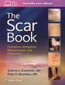 Image for The Scar Book