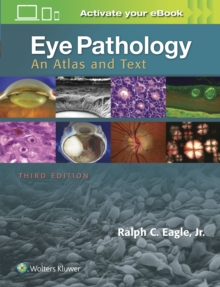 Eye Pathology