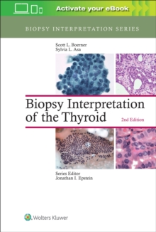 Image for Biopsy Interpretation of the Thyroid