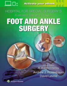 Hospital for Special Surgery’s Illustrated Tips and Tricks in Foot and Ankle Surgery