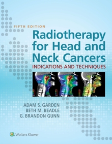 Image for Radiotherapy for head and neck cancers: indications and techniques