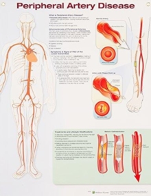 Image for Peripheral Artery Disease