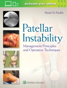 Patellar Instability: Management Principles and Operative Techniques