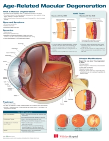 Image for Age-Related Macular Degeneration Anatomical Chart