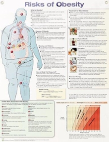 Image for Risks of Obesity Anatomical Chart Laminated