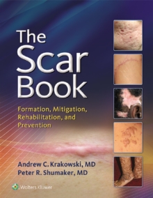 Image for The scar book: formation, mitigation, rehabilitation, and prevention