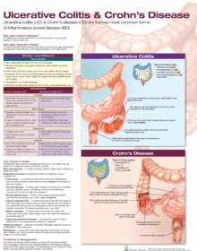Ulcerative Colitis & Crohn's Disease Anatomical Chart Laminated