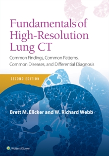 Fundamentals of High-Resolution Lung CT: Common Findings, Common Patterns, Common Diseases and Differential Diagnosis