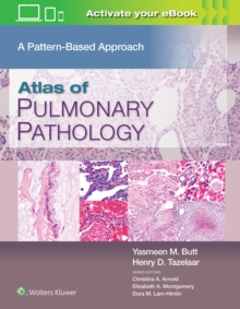 Image for Atlas of pulmonary pathology  : a pattern based approach to neoplastic and non-neoplastic biopsies