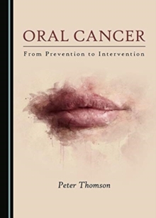 Image for Oral Cancer