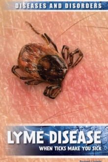 Image for Lyme disease: when ticks make you sick