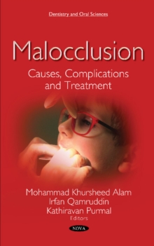 Image for Malocclusion : Causes, Complications and Treatment