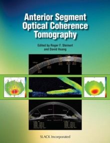 Image for Anterior Segment Optical Coherence Tomography