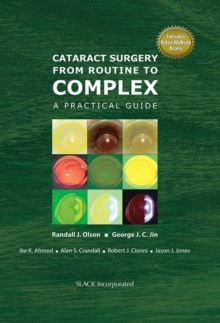 Image for Cataract surgery from routine to complex  : a practical guide
