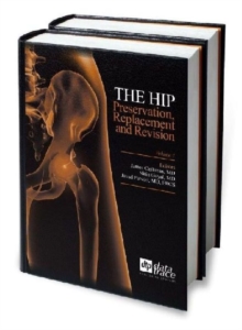 Hip