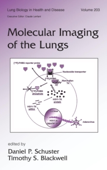 Image for Molecular Imaging of the Lungs