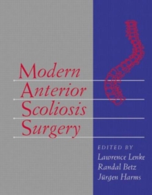 Image for Modern anterior scoliosis surgery