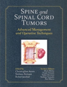 Image for Spine and Spinal Cord Tumors