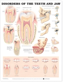 Image for Disorders of the Teeth and Jaw Anatomical Chart