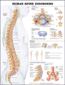 Image for Human Spine Disorders Anatomical Chart