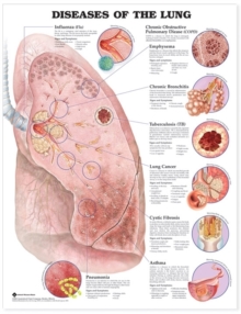 Image for Diseases of the Lung