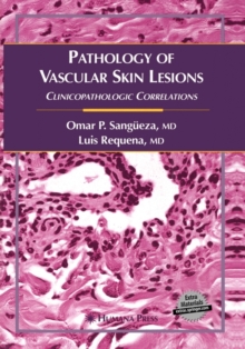 Image for Pathology of Vascular Skin Lesions