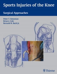Sports Injuries of the Knee