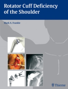 Image for Rotator Cuff Deficiency of the Shoulder