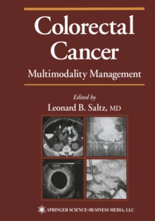 Image for Colorectal cancer: evidence-based chemotherapy strategies