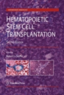 Image for Hematopoietic stem cell transplantation