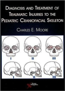 Image for Diagnosis and Treatment of Traumatic Injuries to the Pediatric Craniofacial Skeleton