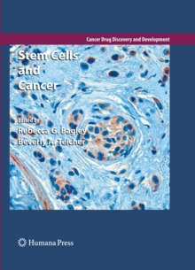 Image for Stem cells and cancer
