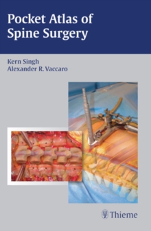 Image for Pocket Atlas of Spine Surgery